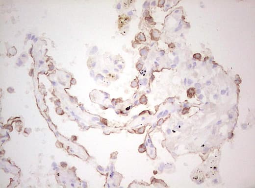 Monoclonal Mouse anti-Human Basic Cytokeratin AE3 Antibody (clone AE3, Carrier-free, IHC)
