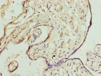 DNAJB8 Antibody