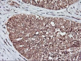 KCNAB1 Antibody (clone OTI7C7)