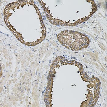 CASP12 / Caspase 12 Antibody