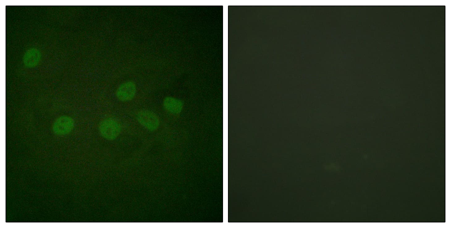 Polyclonal Rabbit anti-Human CREBBP / CREB Binding Protein Antibody (aa1501-1550, IHC, IF, WB)