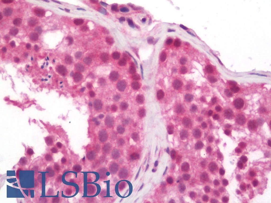 IHC-plus™ HDAC4 Antibody (aa1052-1084)