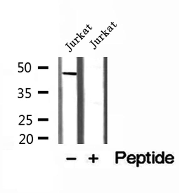Polyclonal Rabbit anti-Human MAGT1 Antibody (IHC, WB)