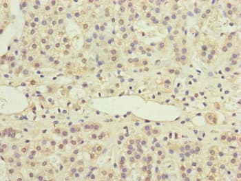 Polyclonal Rabbit anti-Human PPP2R3B Antibody (IHC)