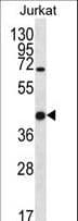GAL4 / Galectin 4 Antibody (aa70-98)