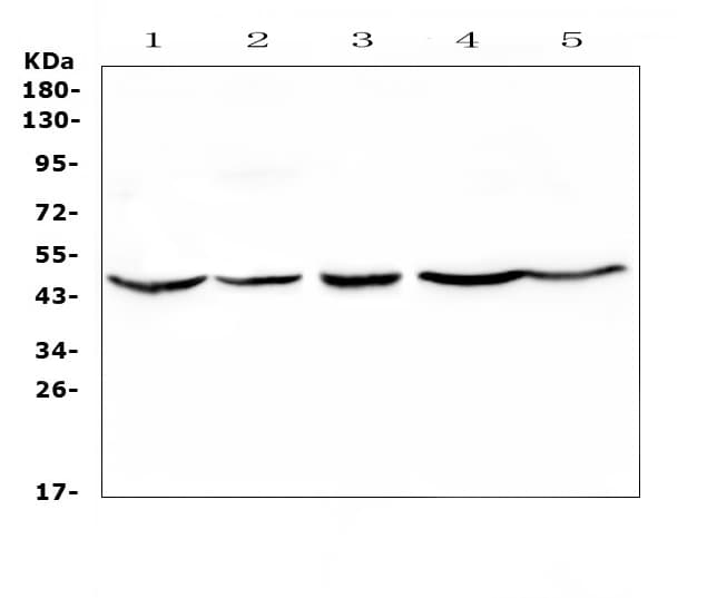 HMBS / PBGD Antibody