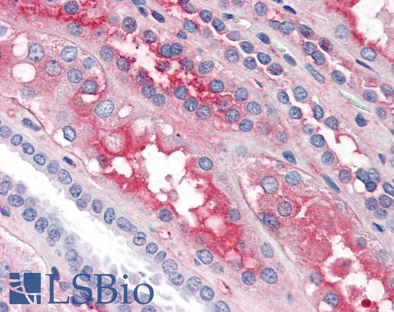 IHC-plus™ F12 / Factor XII Antibody