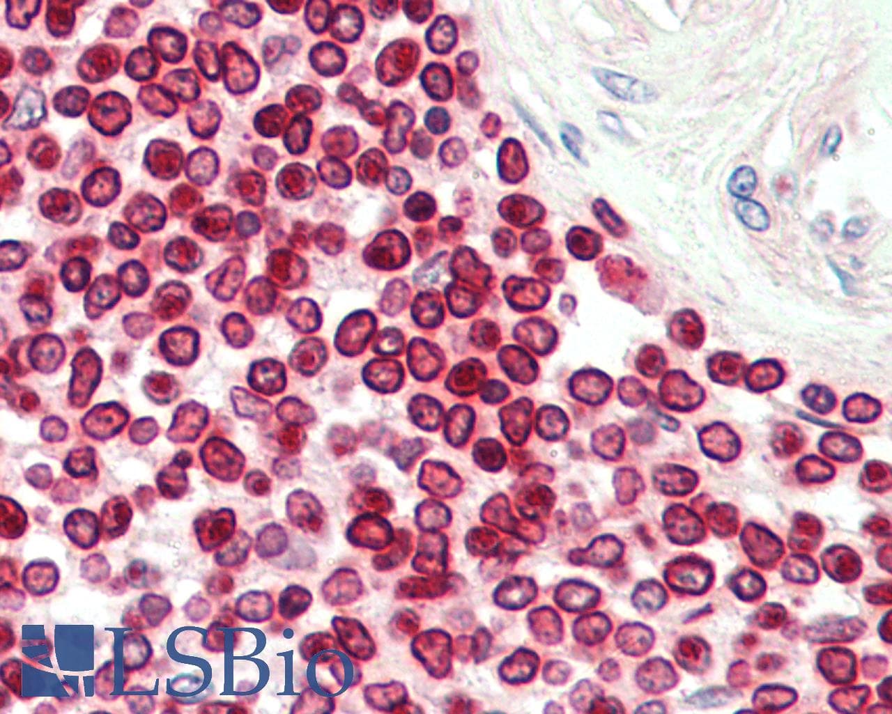 IHC-plus™ LMNB1 / Lamin B1 Antibody (aa289-574)