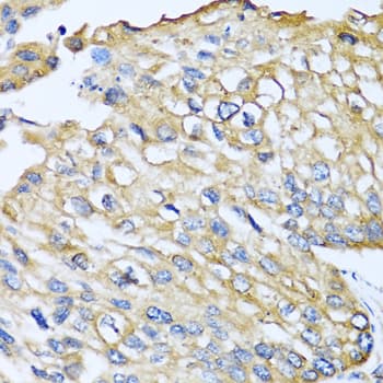 CCL8 / MCP2 Antibody