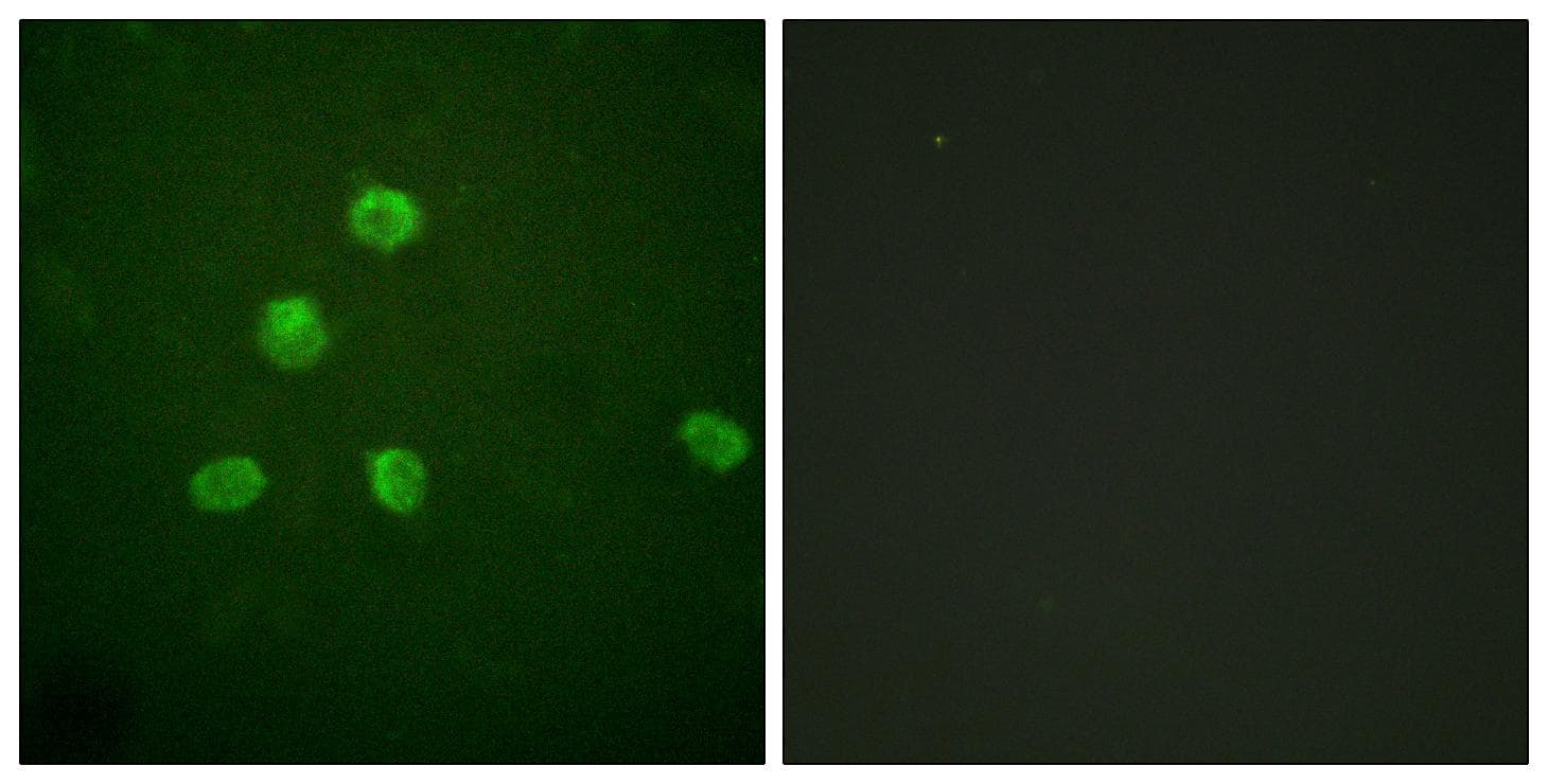 FOSB Antibody (p27)