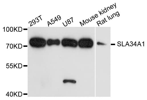 IHC-plus™ SLC34A1 / NPT2 Antibody