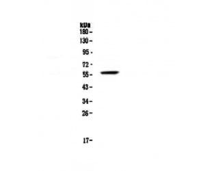 Polyclonal Rabbit anti-Human FGR Antibody (WB)