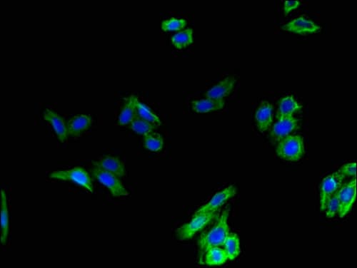 Polyclonal Rabbit anti-Human GCGR / Glucagon Receptor Antibody (aa26-136, IHC, IF, WB)