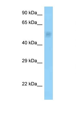 Polyclonal Rabbit anti-Rat PPP2R3C Antibody (aa58-107, WB)