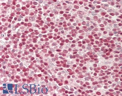 IHC-plus™ Polyclonal Rabbit anti-Human KDM4B / JMJD2B Antibody (aa1056-1096, IHC, WB)
