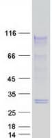 Human ATXN1 / SCA1 Protein (Recombinant Myc-DDK (Flag))