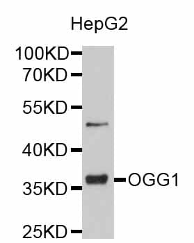 IHC-plus™ Polyclonal Rabbit anti-Human OGG1 Antibody (IHC, WB)