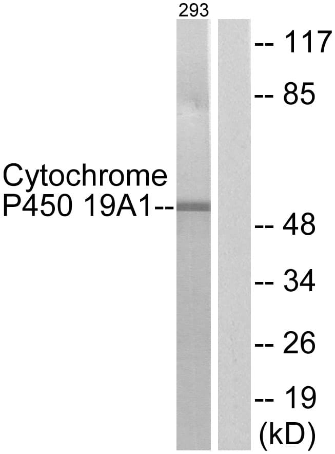 CYP19 / Aromatase Antibody (aa221-270)