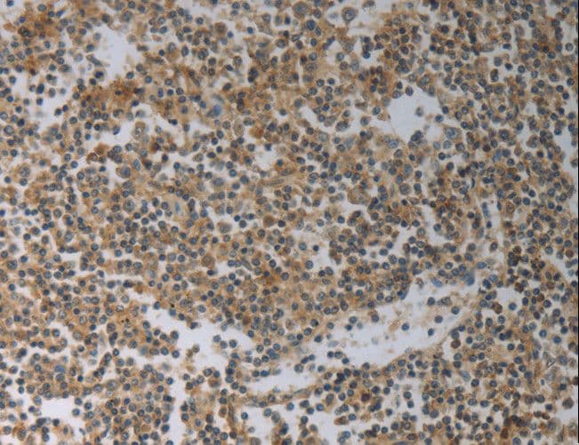 SLC4A7 Antibody