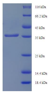 Human IFT27 / RABL4 Protein (Recombinant His-SUMO)