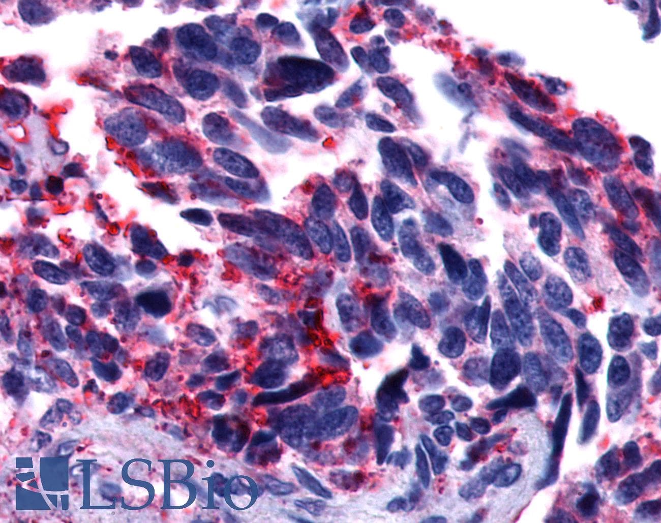 PathPlus™ GPCR6 / GPR101 Antibody (Cytoplasmic Domain)