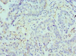 ARG2 / Arginase 2 Antibody (aa1-354)