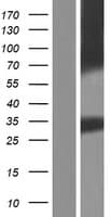 Human AQP12B / Aquaporin 12B Protein (Over-Expression Lysate Myc-DDK (Flag))