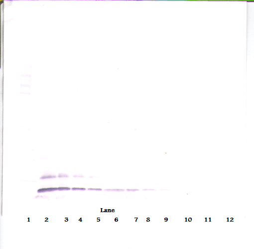CCL17 / TARC Antibody