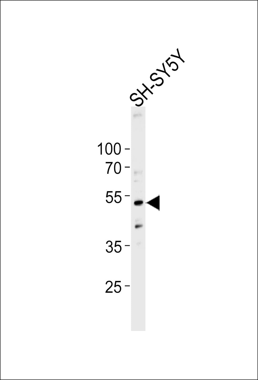 Dynactin 2 / Dynamitin Antibody (aa192-219)