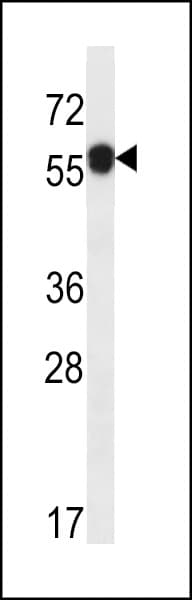 ARMT1 Antibody (aa29-57)