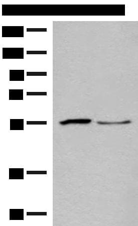 SLC2A8 / GLUT8 Antibody