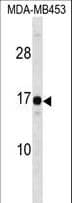 HMGN3 Antibody (aa1-30)