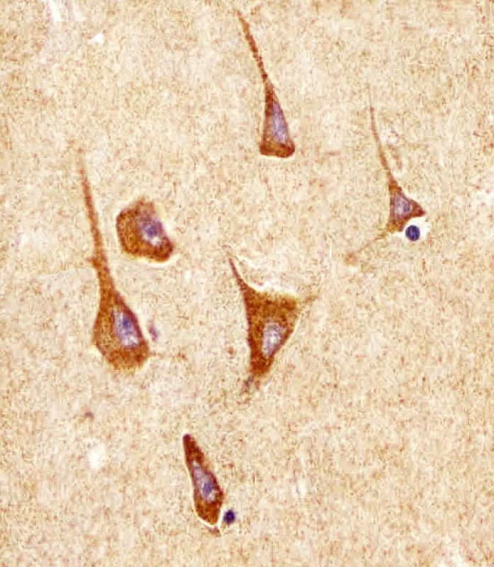 Monoclonal Mouse anti-Human SOD2 / Mn SOD Antibody (clone 1559CT572.3.83, IHC, WB)
