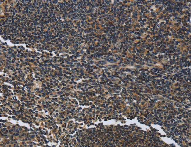 LGALS7 / Galectin 7 Antibody