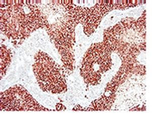 IHC-plus™ ERBB2 / HER2 Antibody (clone 3B5)