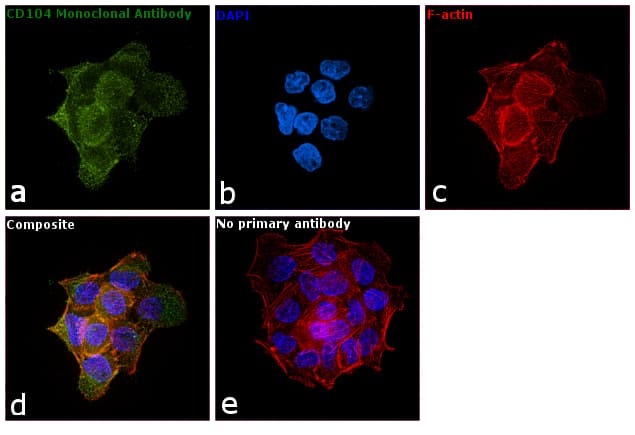 ITGB4 / Integrin Beta 4 Antibody (Amino Acid: 1619-1822, clone 10B10D5)