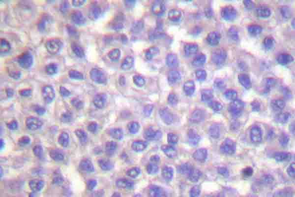 BCAR1 / p130Cas Antibody (phospho-Tyr410)