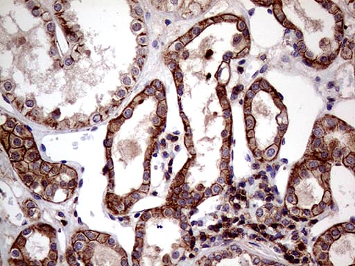 SEMA4D / Semaphorin 4D / CD100 Antibody (clone OTI6G1)