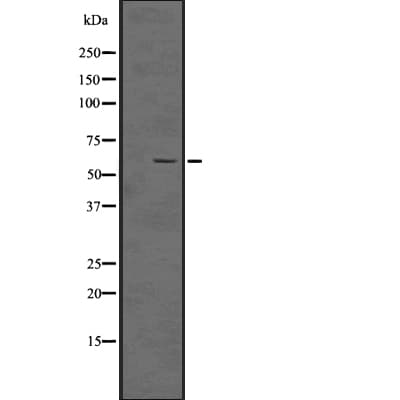 Polyclonal Rabbit anti-Human RNF20 Antibody (IF, WB)