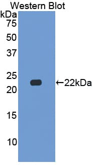 CSN2 / Beta Casein Antibody (aa41-198)