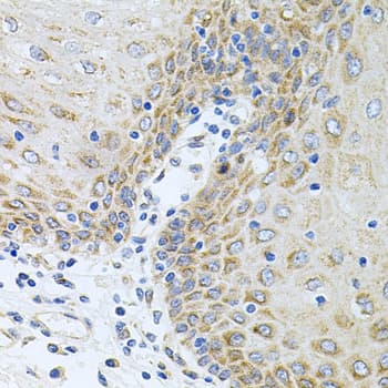 CPM / Carboxypeptidase M Antibody