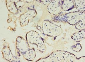 CSHL1 / CSH-Like 1 Antibody (aa1-128)