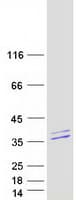 Human SPRYD4 Protein (Recombinant Myc-DDK (Flag))