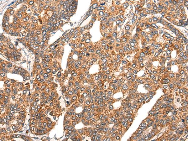 EPHA6 / EPH Receptor A6 Antibody