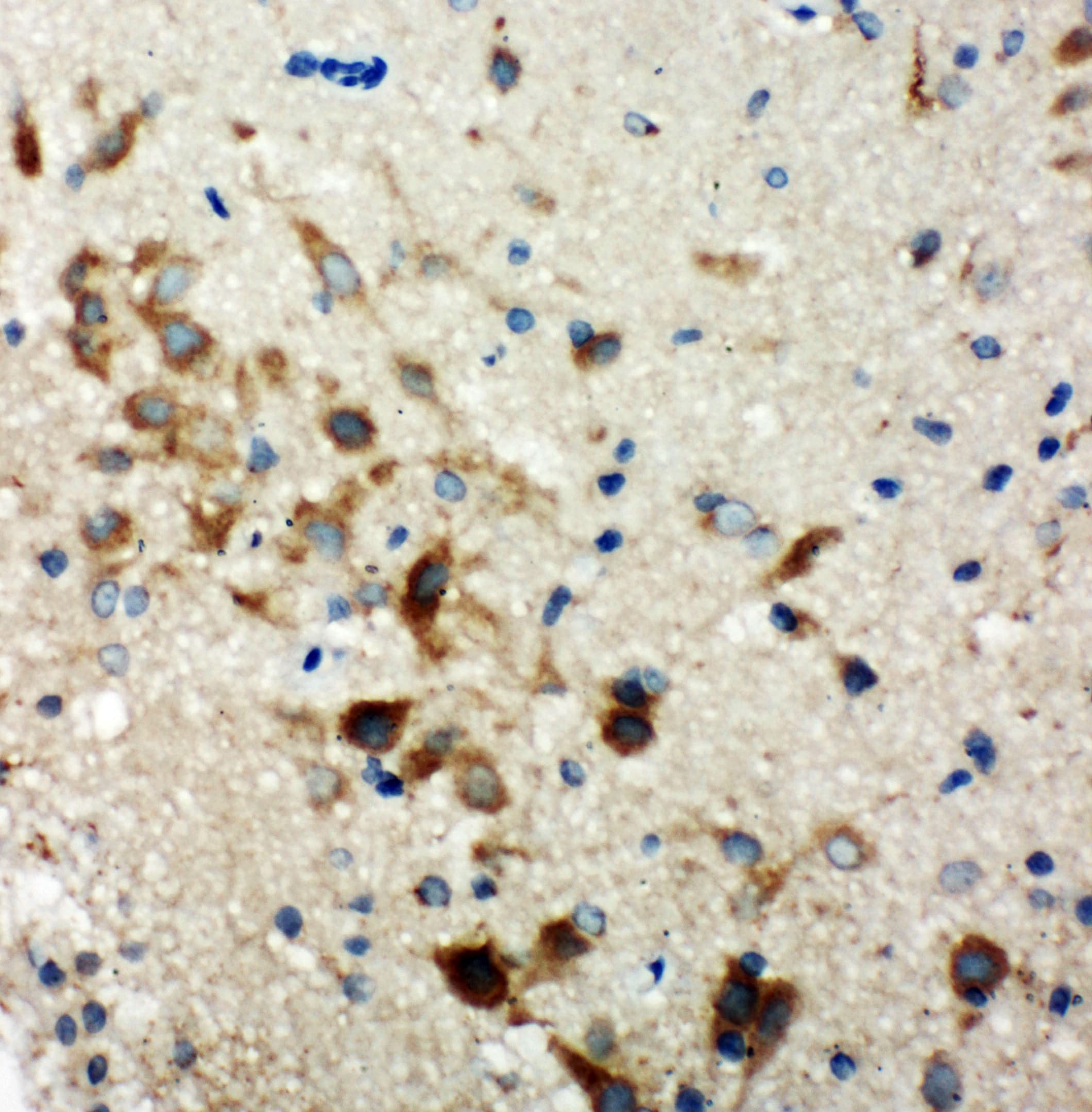 Polyclonal Rabbit anti-Human Hamartin / TSC1 Antibody (aa1150-1164, IHC, WB)