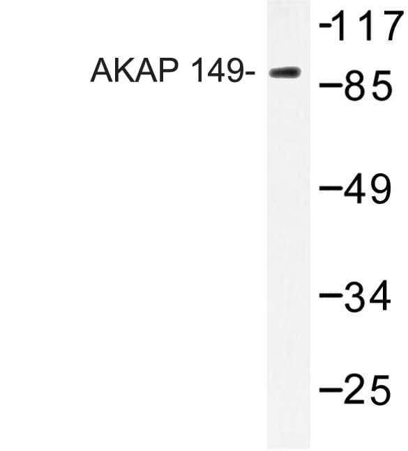 AKAP1 / AKAP Antibody (Asn306)