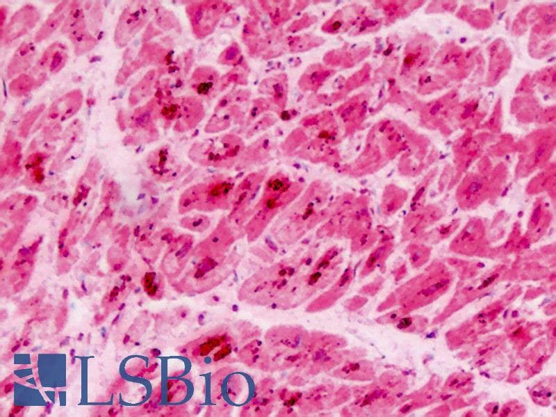 IHC-plus™ PUM2 Antibody (Ser182)