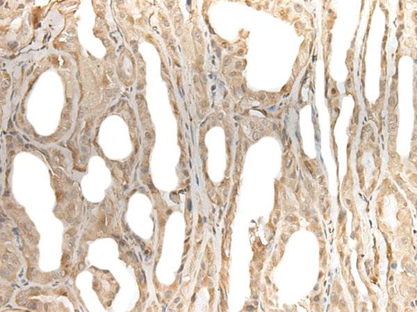 Polyclonal Rabbit anti-Human ZNF238 Antibody (IHC)