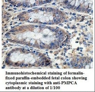 PMPCA Antibody (aa186-370)