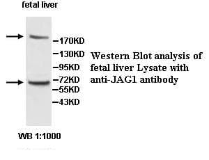 JAG1 / Jagged 1 Antibody (aa469-746)